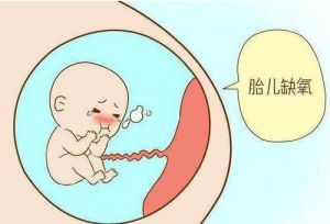 假性宫缩说明胎儿缺氧 胎儿胎动频繁易患脑瘫